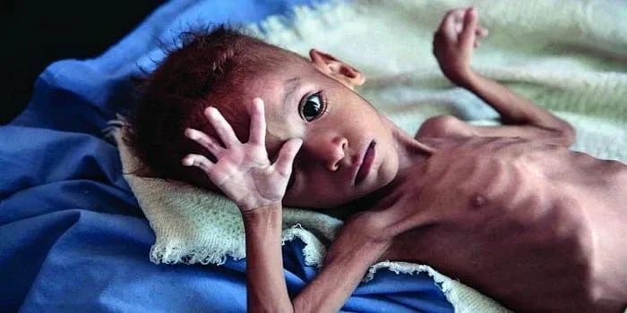 Malnutrition Elimination & Child Wellness